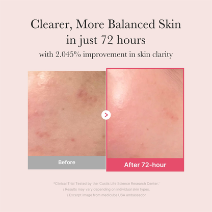 medicube TXA+Niacinamide 15% Glow Facial Seurm